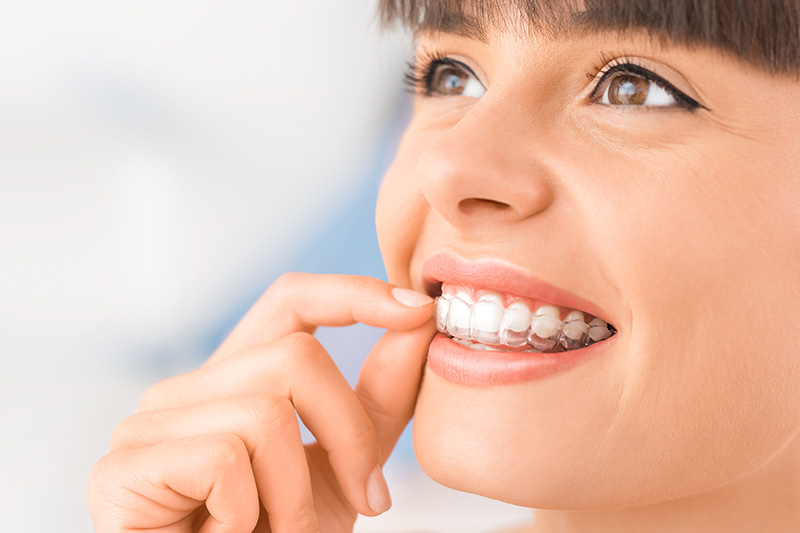 Invisalign in Clarksburg