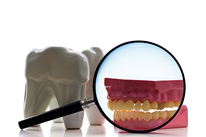 Root Canal Treatment in Clarksburg